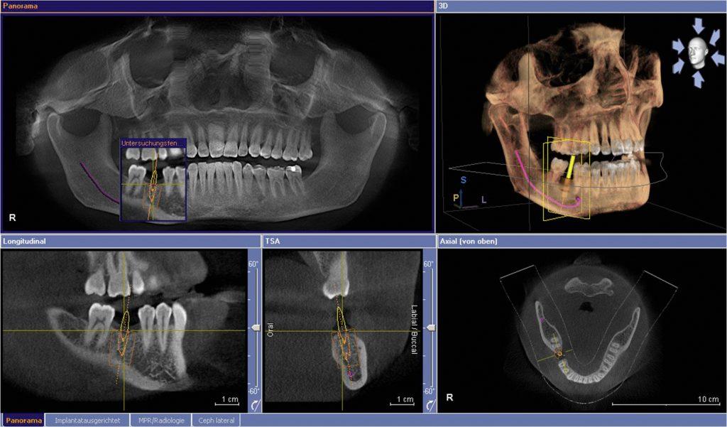 Диагностика зубочелюстной системы — фото/изображения/картинки | Edclinic